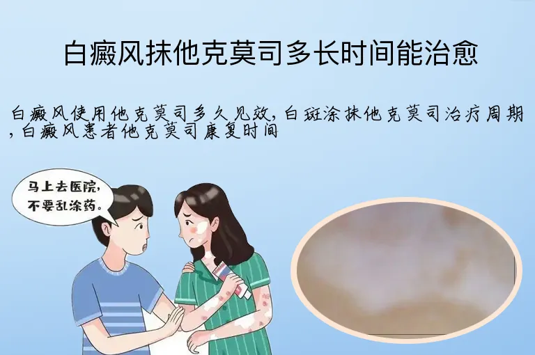 白癜风抹他克莫司多长时间能治愈