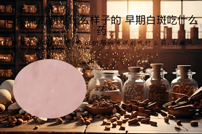 白癜风初期是什么样子的 早期白斑吃什么药