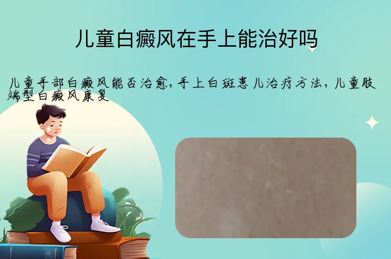儿童白癜风在手上能治好吗
