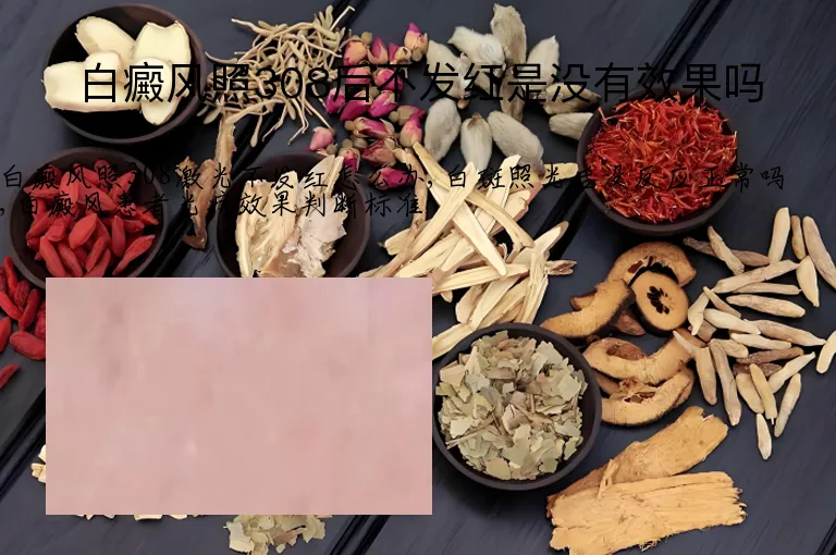 白癜风照308后不发红是没有效果吗