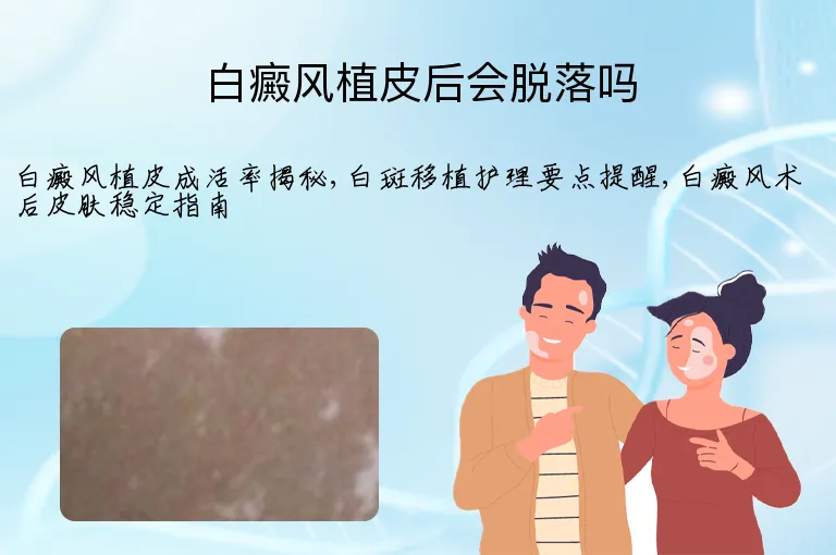 白癜风植皮后会脱落吗