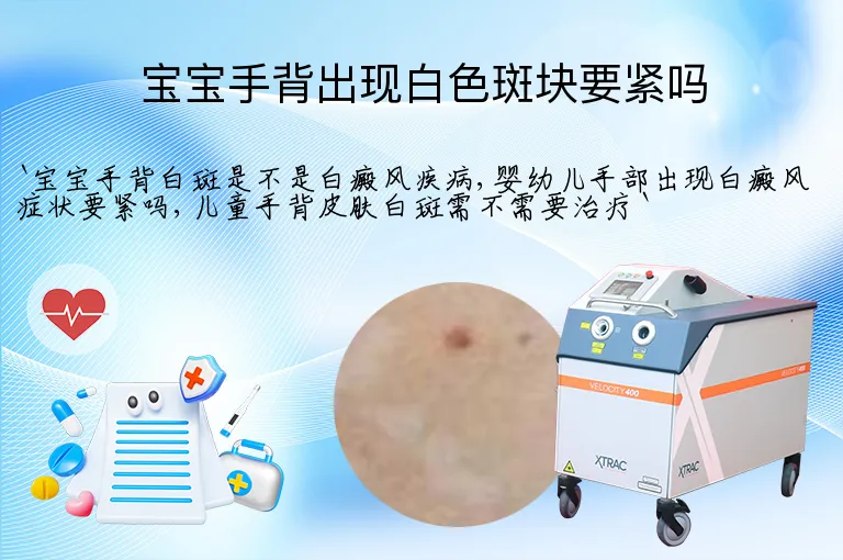 宝宝手背出现白色斑块要紧吗