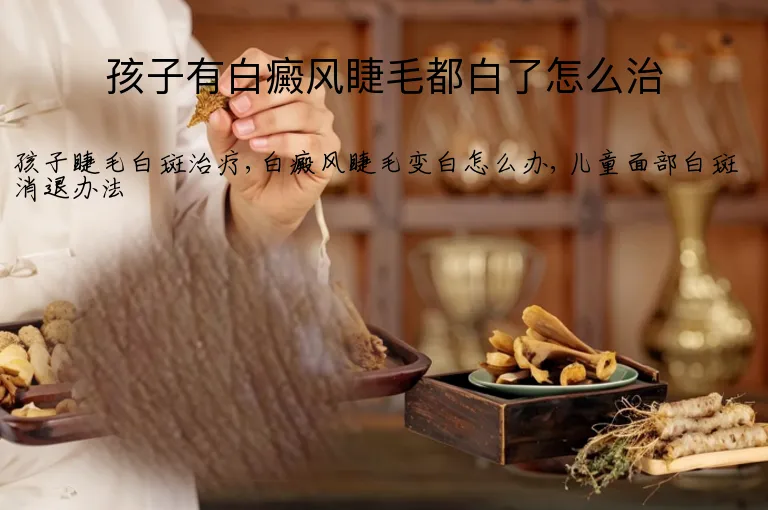 孩子有白癜风睫毛都白了怎么治
