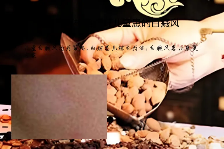 要怎么样治疗好儿童患的白癜风