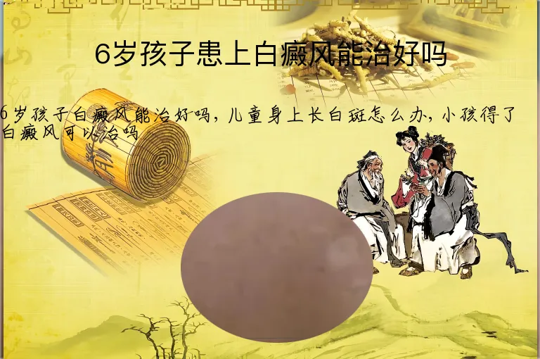 6岁孩子患上白癜风能治好吗