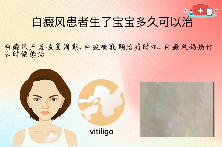 白癜风患者生了宝宝多久可以治
