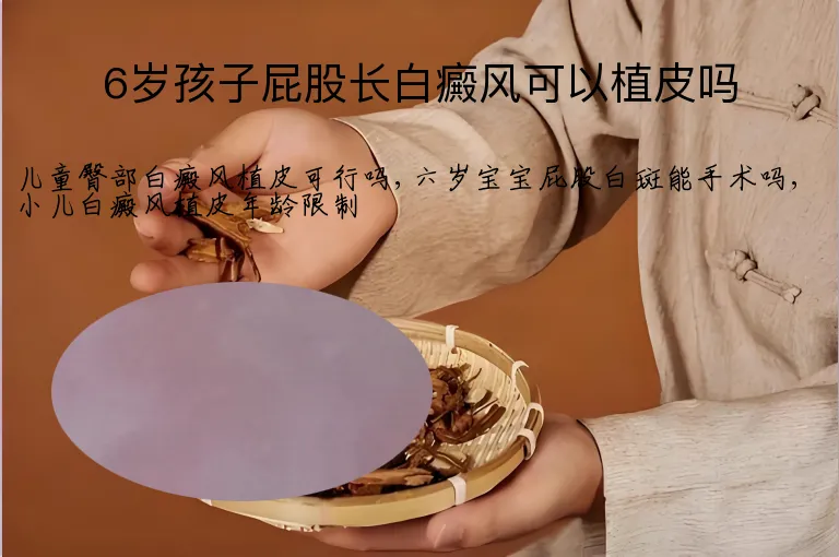 6岁孩子屁股长白癜风可以植皮吗