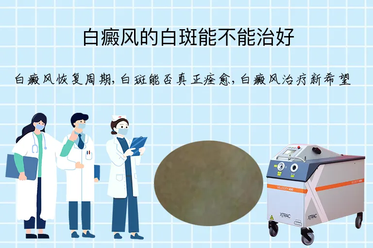 白癜风的白斑能不能治好