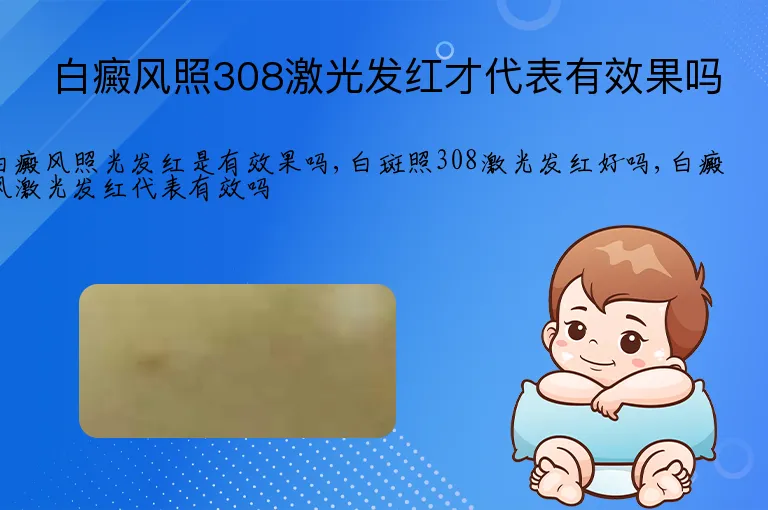 白癜风照308激光发红才代表有效果吗