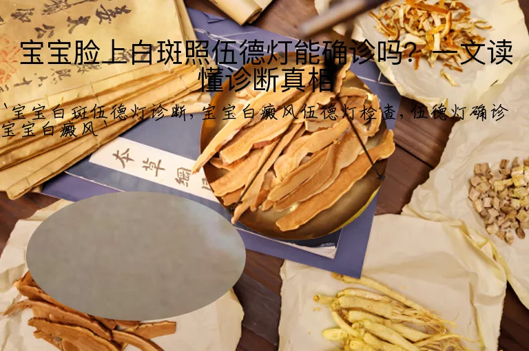 宝宝脸上白斑照伍德灯能确诊吗?一文读懂诊断真相