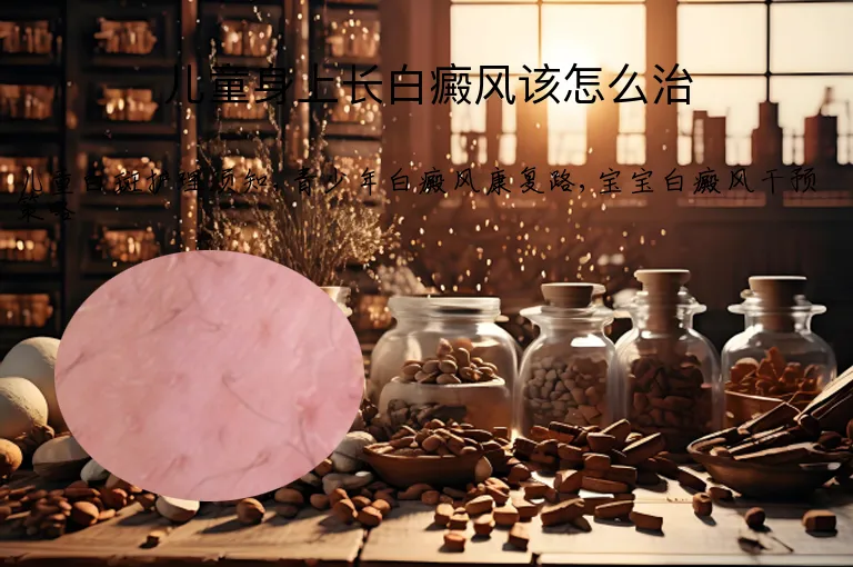 儿童身上长白癜风该怎么治