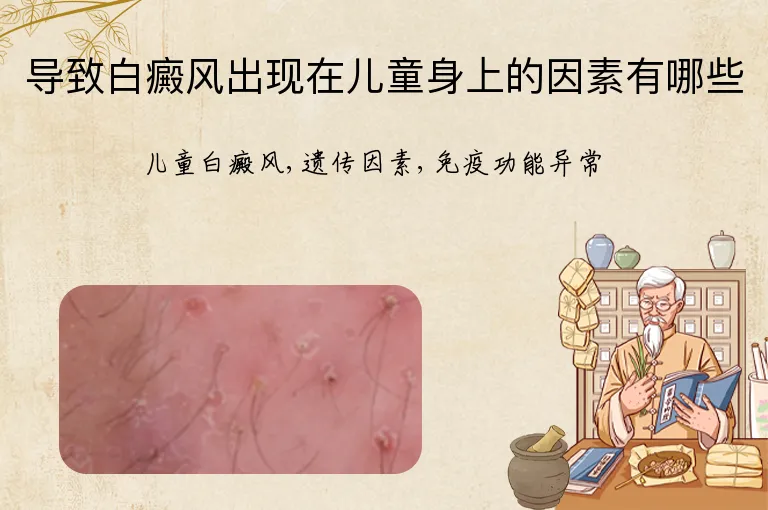 导致白癜风出现在儿童身上的因素有哪些