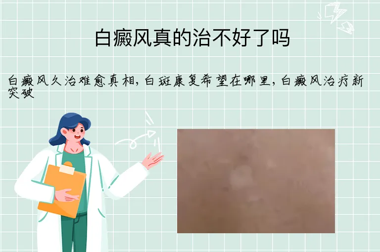 白癜风真的治不好了吗