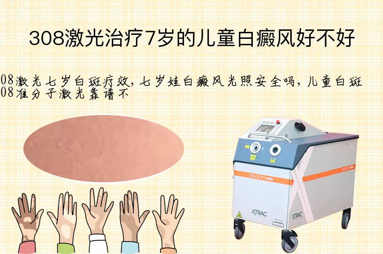 308激光治疗7岁的儿童白癜风好不好