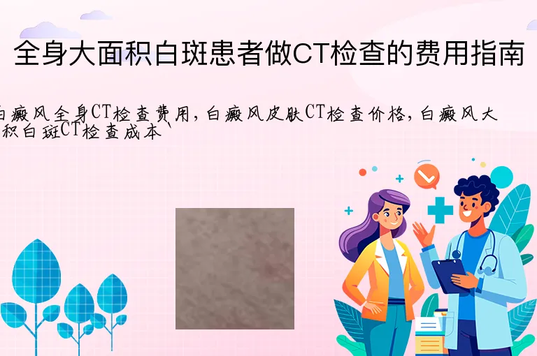 全身大面积白斑患者做CT检查的费用指南