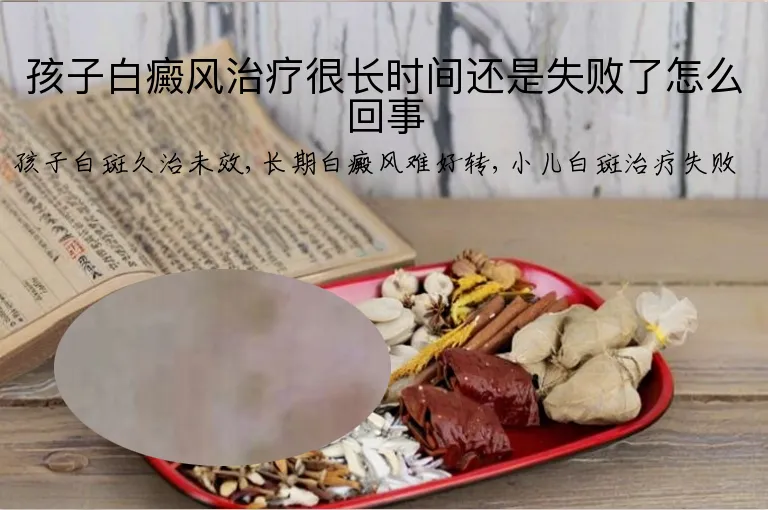 孩子白癜风治疗很长时间还是失败了怎么回事