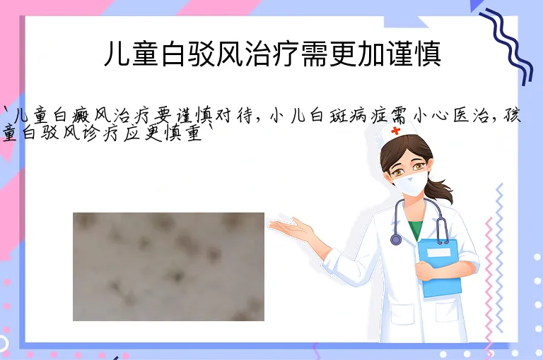 儿童白驳风治疗需更加谨慎