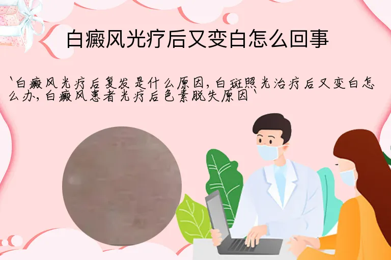 白癜风光疗后又变白怎么回事