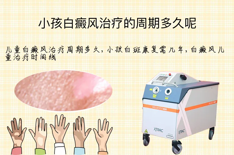 小孩白癜风治疗的周期多久呢