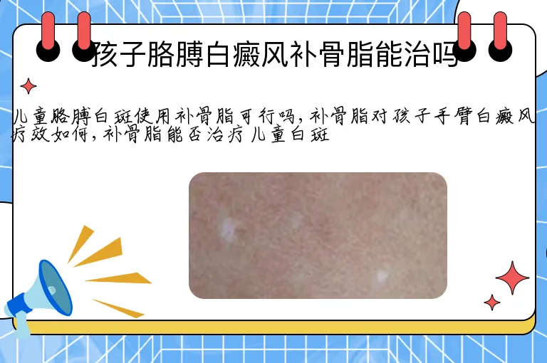 孩子胳膊白癜风补骨脂能治吗