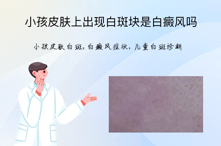 小孩皮肤上出现白斑块是白癜风吗