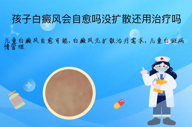 孩子白癜风会自愈吗没扩散还用治疗吗