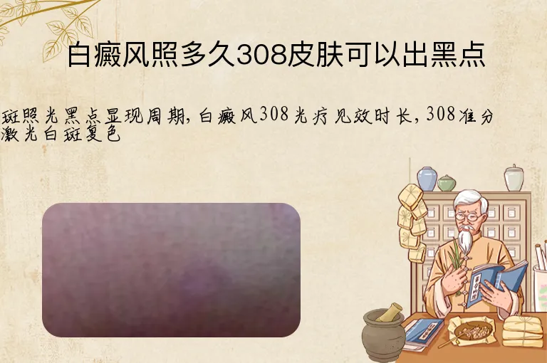 白癜风照多久308皮肤可以出黑点