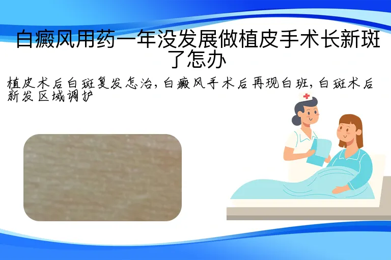 白癜风用药一年没发展做植皮手术长新斑了怎办