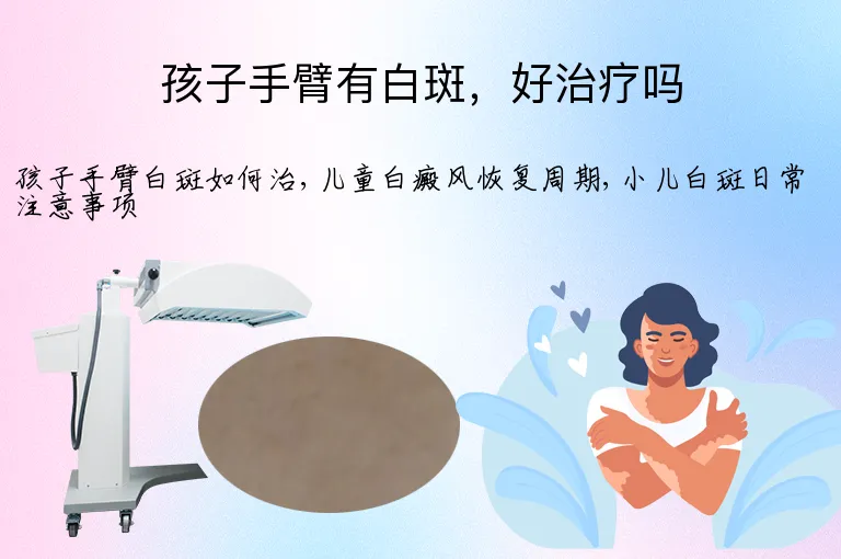 孩子手臂有白斑,好治疗吗