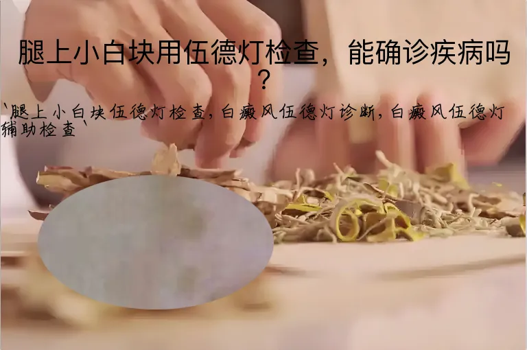 腿上小白块用伍德灯检查，能确诊疾病吗？