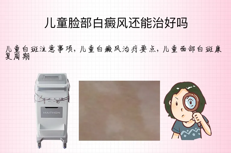 儿童脸部白癜风还能治好吗