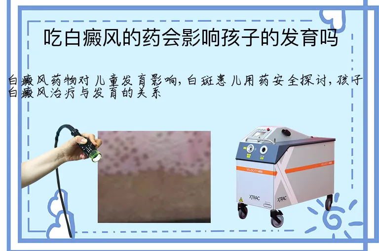 吃白癜风的药会影响孩子的发育吗