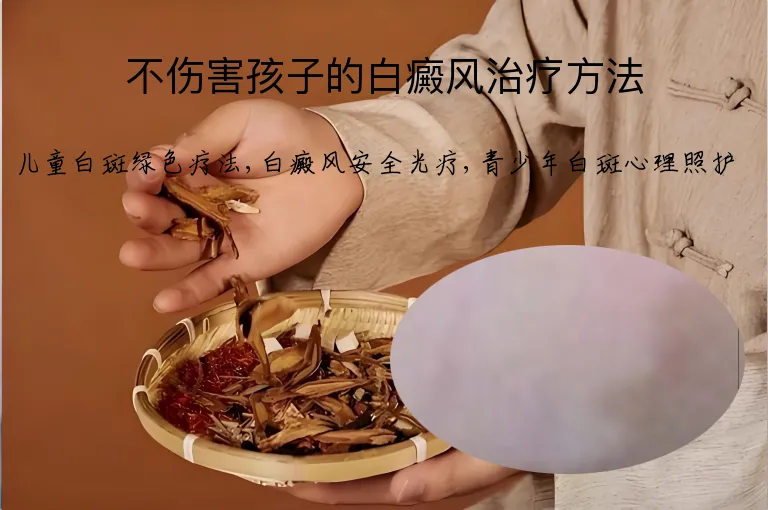 不伤害孩子的白癜风治疗方法