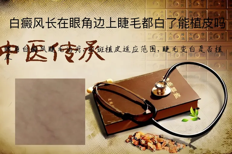 白癜风长在眼角边上睫毛都白了能植皮吗