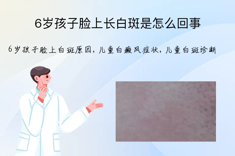 6岁孩子脸上长白斑是怎么回事