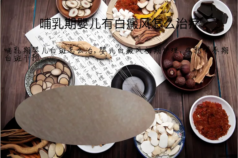 哺乳期婴儿有白癜风怎么治疗