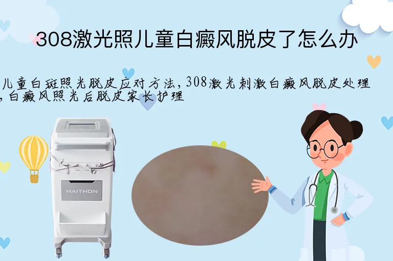 308激光照儿童白癜风脱皮了怎么办