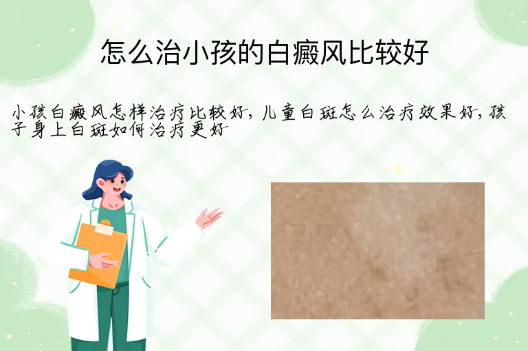 怎么治小孩的白癜风比较好