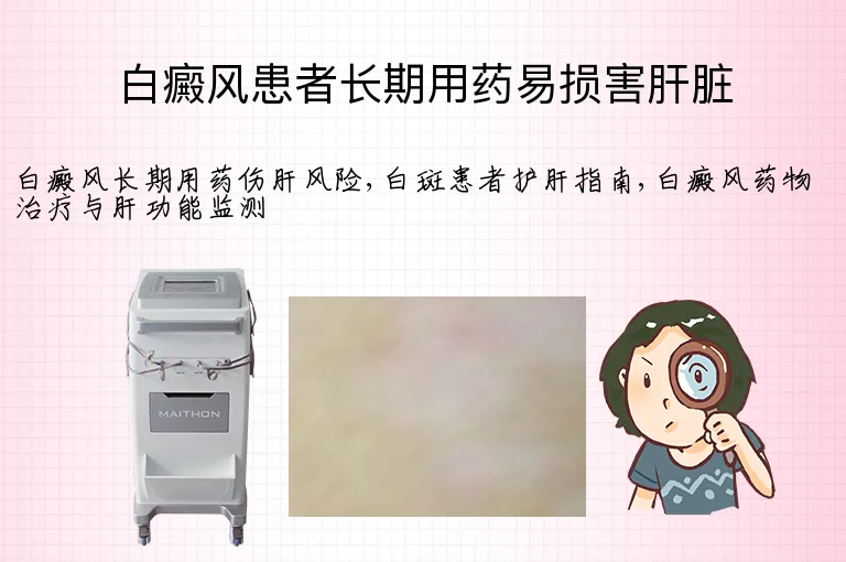 白癜风患者长期用药易损害肝脏