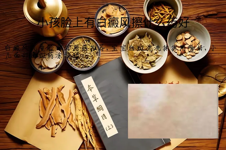 小孩脸上有白癜风擦什么药好