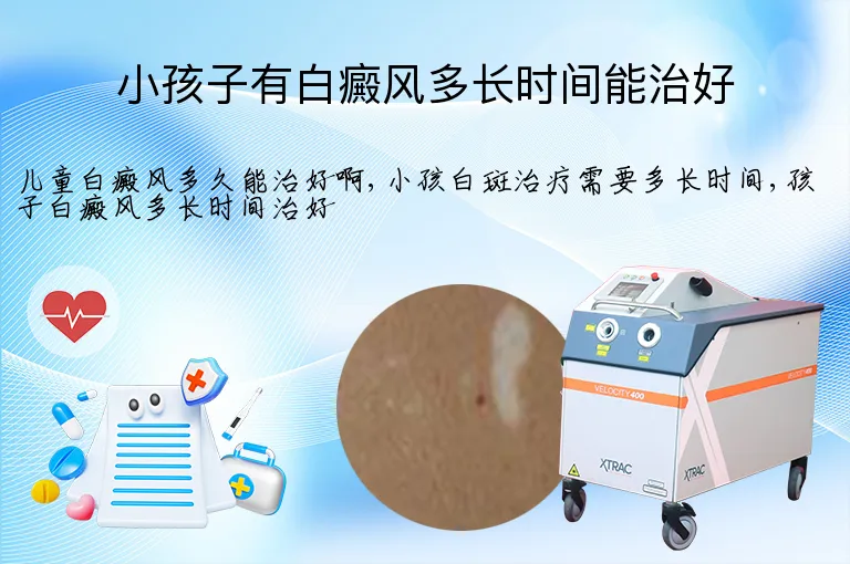小孩子有白癜风多长时间能治好