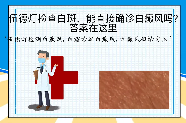 伍德灯检查白斑，能直接确诊白癜风吗？答案在这里