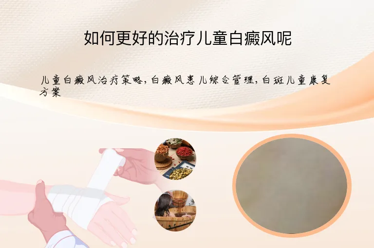 如何更好的治疗儿童白癜风呢