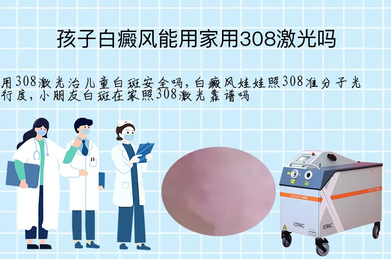 孩子白癜风能用家用308激光吗