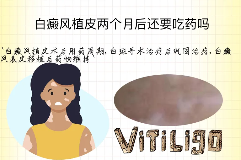 白癜风植皮两个月后还要吃药吗