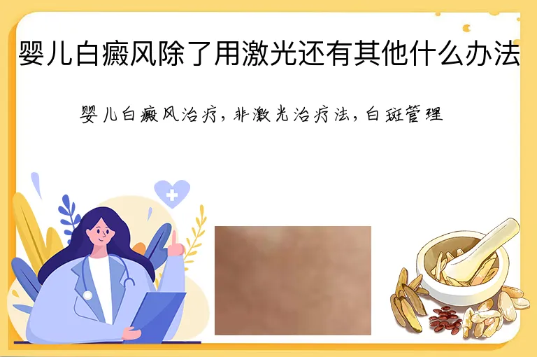 婴儿白癜风除了用激光还有其他什么办法