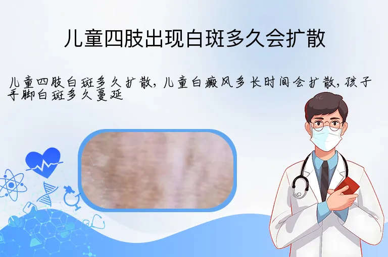 儿童四肢出现白斑多久会扩散