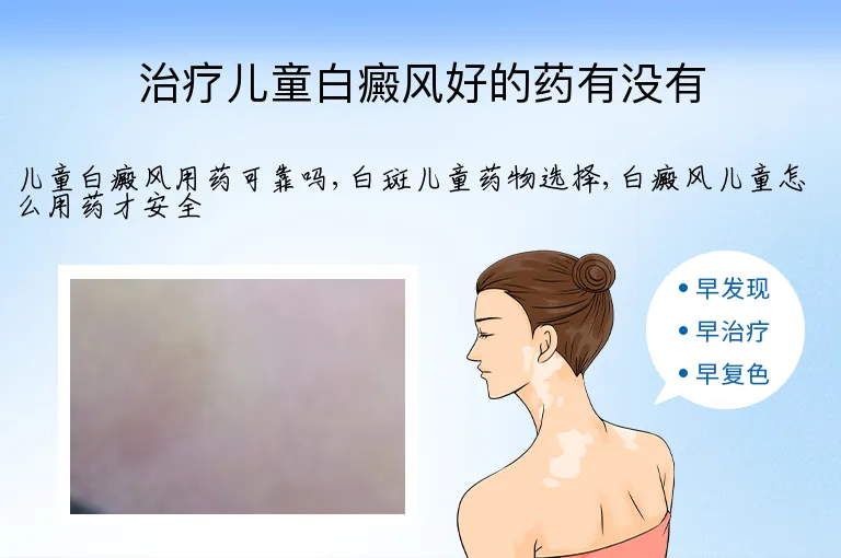治疗儿童白癜风好的药有没有