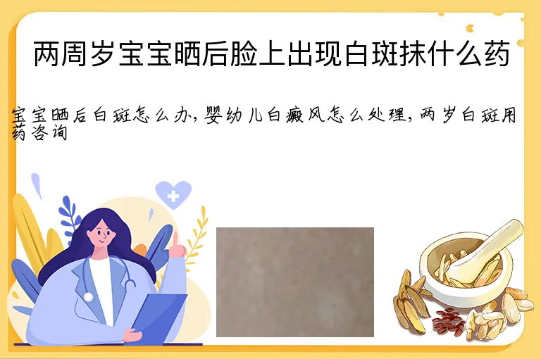 两周岁宝宝晒后脸上出现白斑抹什么药