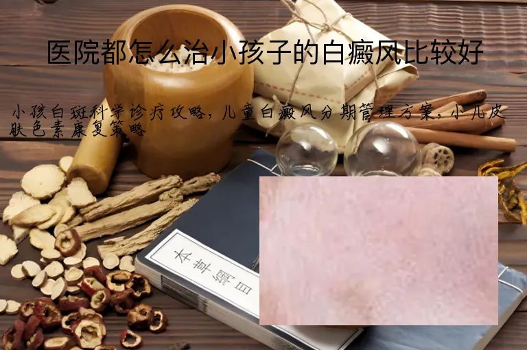 医院都怎么治小孩子的白癜风比较好